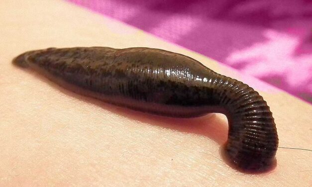 Amputálni kellett egy nő lábát, miután a vecsési természetgyógyásztól piócás kezelést kapott