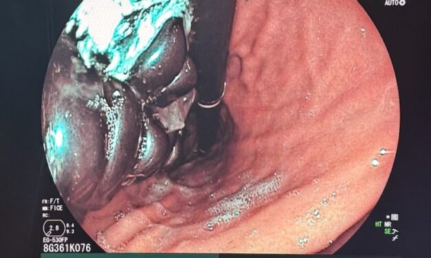 20 mágnest nyelt le egy 10 éves gyerek, a Heim Pál kórházban mentették meg az életét